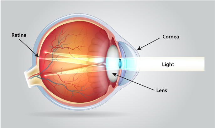 Astigmatisme diagram